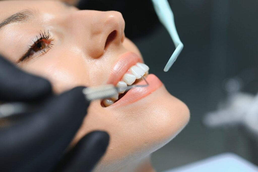 Smile Makeovers